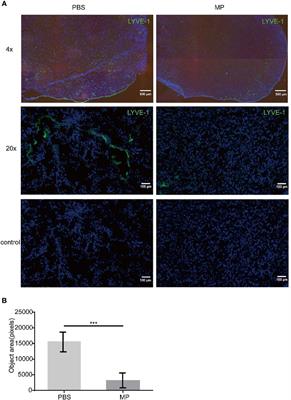 Polysaccharides From Lentinus Edodes Inhibits Lymphangiogenesis via the Toll-Like Receptor 4/JNK Pathway of Cancer-Associated Fibroblasts